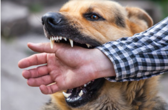 梦见狗咬到手是什么意思梦见狗咬到手有什么预兆